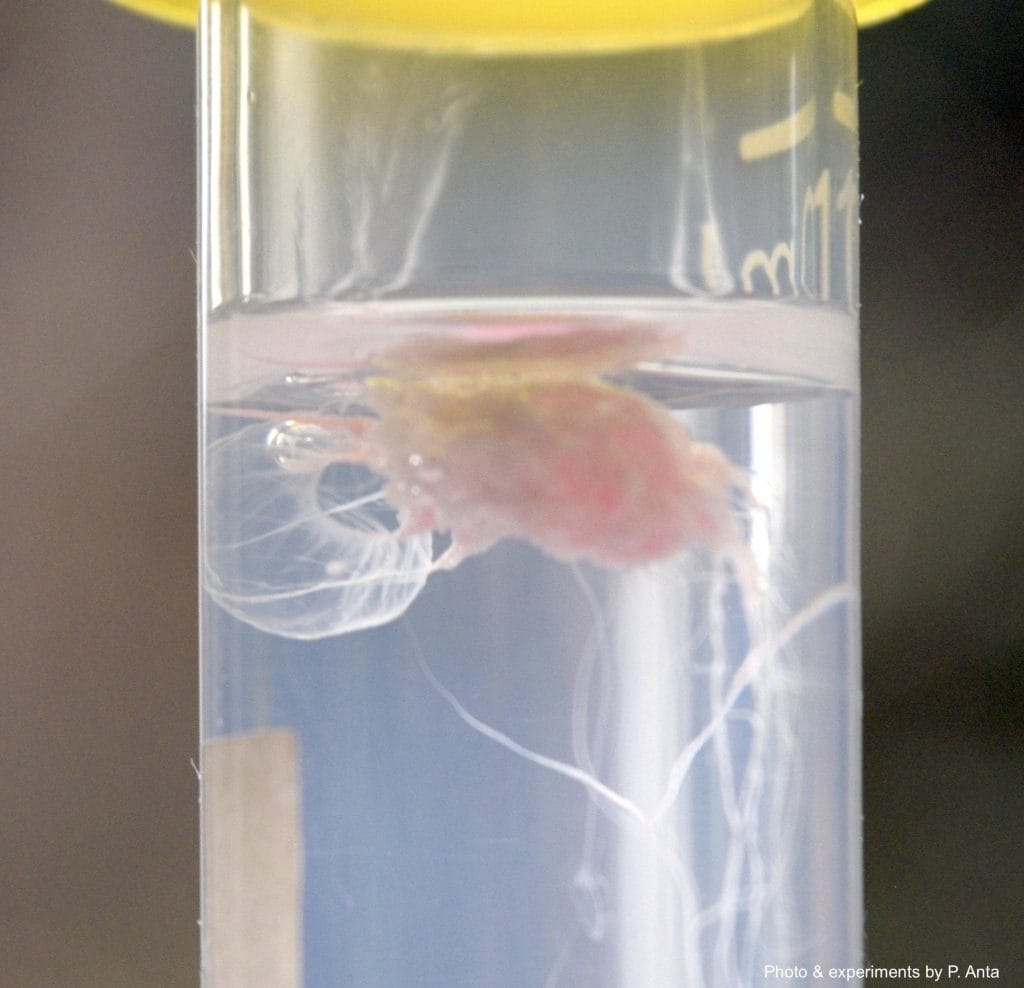 DNA Extraction from Whole Blood